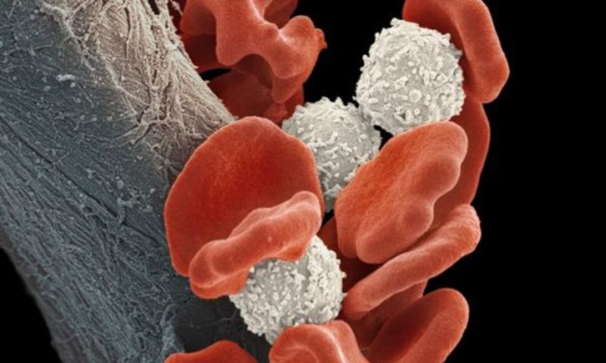 A Unimore una importante scoperta sui tumori del sangue