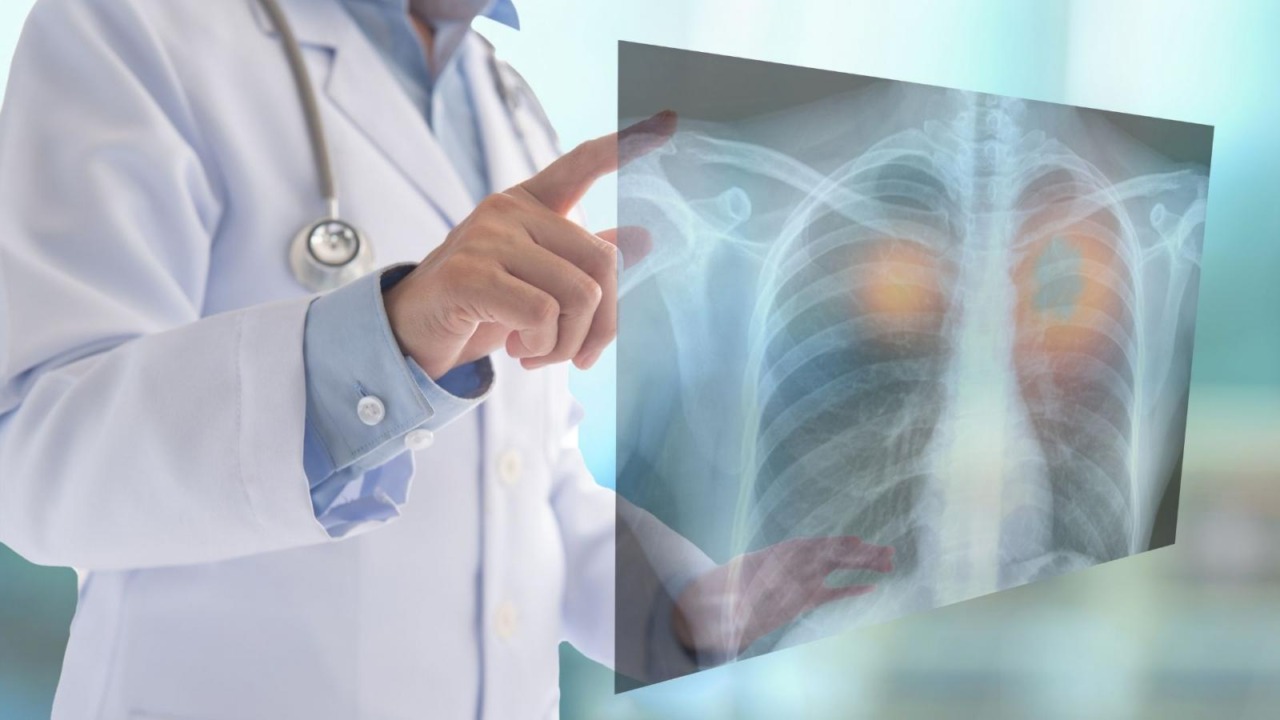 Dal 20 luglio le prestazioni di radiologia tradizionale di tipo U e B dovranno essere prenotate