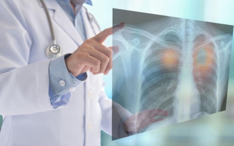 Dal 20 luglio le prestazioni di radiologia tradizionale di tipo U e B dovranno essere prenotate